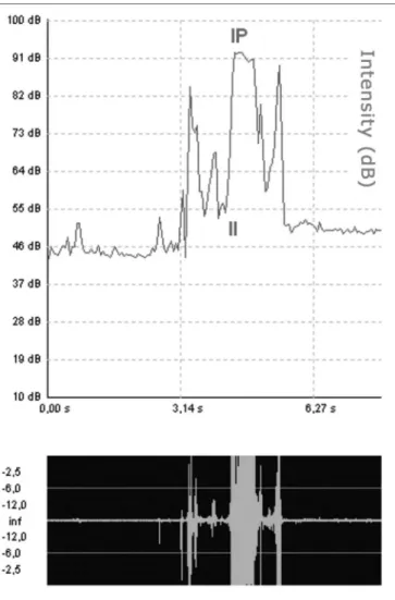 Figure 6. Swallowing time