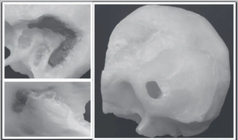 Figure 4. Surgical simulator.