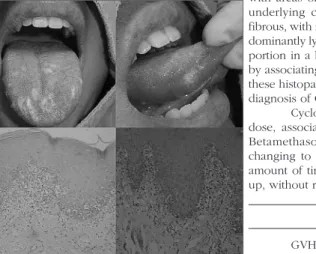 Figure 1. Upper part - diffuse whitish lesions on the tongue dor- dor-sum and lateral border