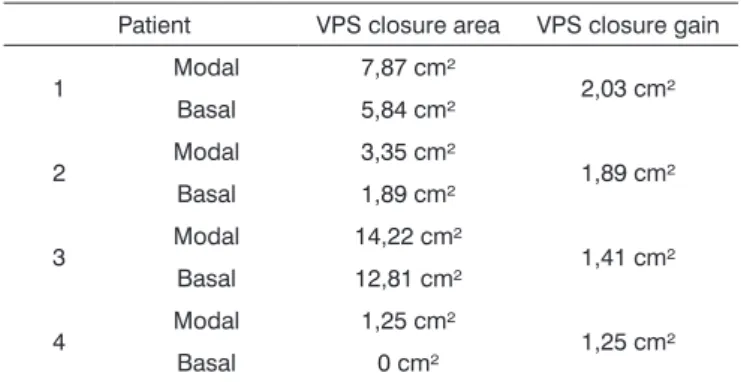 Table 3. Results from the velopharyngeal closure area, calculated by  the Vector Works software