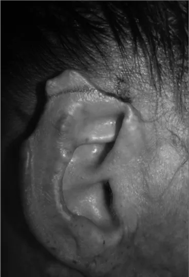 Figure 4a. Burn.