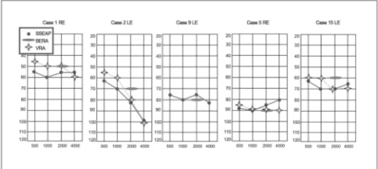 Figure 1. Examples of cases comparing the click-BERA and the SSE- SSE-AP I. - SSESSE-AP: Steady State Evoked Auditory Potentials; Click-BERA: 