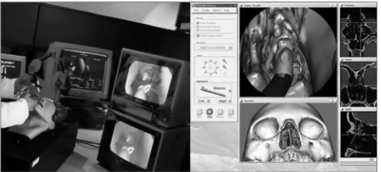 Figure  5.  Images  of  the  S.I.M.O.N.T.  model.  A:  endoscopic  image  (0-degrees, 4mm) of an anatomical dissection of a recent cadaver
