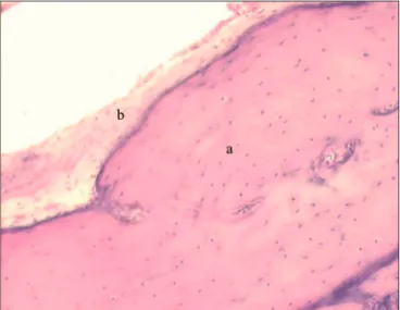Figure 6. a) Stapes; b) long arm of incus; c) vestibule; d) tenor stapes  muscle (small magnification, 3 X).