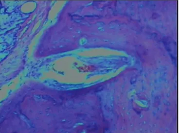 Figure 5. Histological analysis of the hydroxyapatite group.