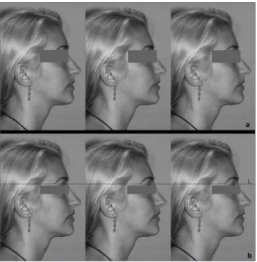 Figure 1. (a) Example of alignment of manipulated images, as shown  to interviewees; from left to right: the regular profile, the higher profile,  and the lower profile