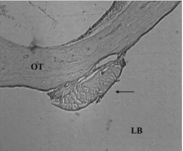Figura 6. Grupo controle. Fotomicrografia da fáscia aderida à mucosa  da bula timpânica