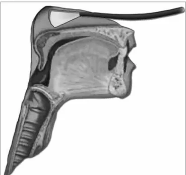 Figure 3b. Rhinopharynx structures and velopharyngeal closure.