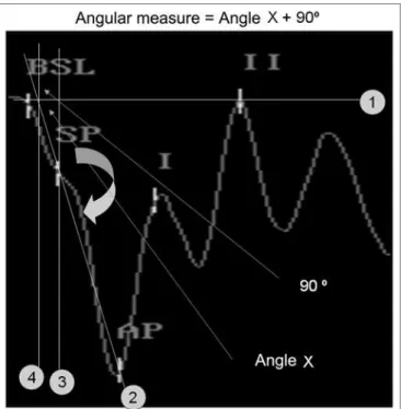 Figure  2.  Steps  to  obtain  the  graphic  method  in  order  to  measure  the angle: