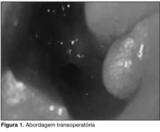 Figura 1. Abordagem transoperatória