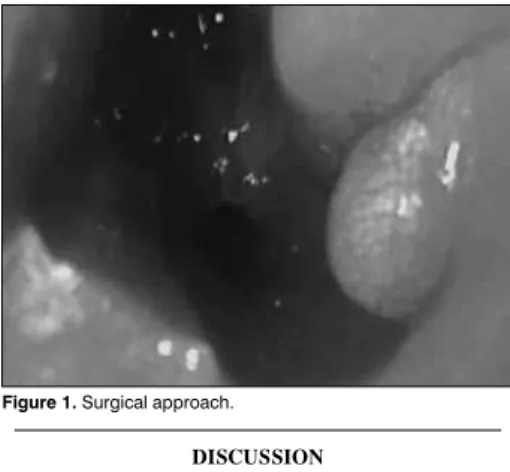Figure 1. Surgical approach.