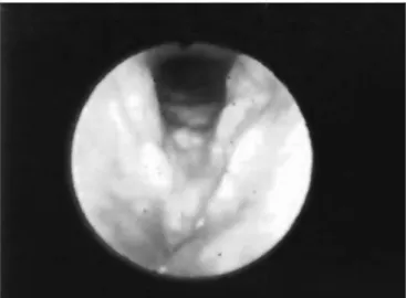Table 1. Compromised laryngeal structures according to frequency.