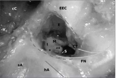 Figure 4. A mastoidectal approach to a lambs’ middle ear (right ear). 
