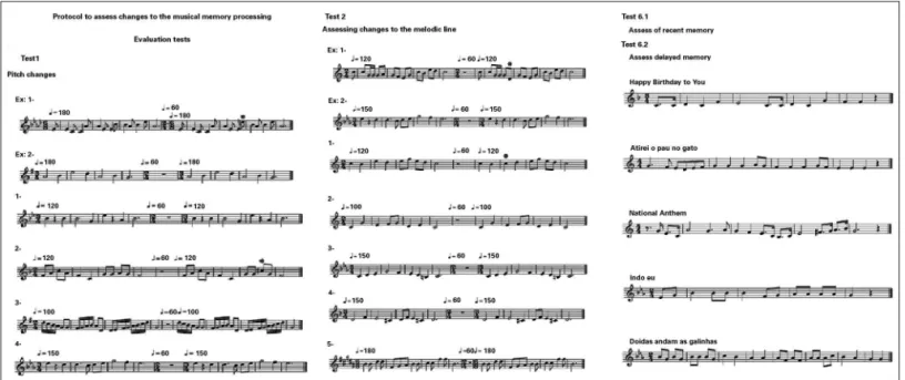 Figure 1. Example of the protocol used in the assessment of music processing - part of the test 1, 2 and 6.