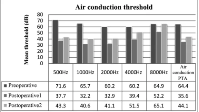 Figure 2.  Mean bone thresholds for each frequency and bone PTA  values.
