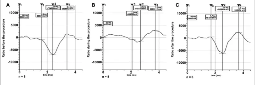 Figure 4. Box plot graph of amplitude at the three experimental time points.