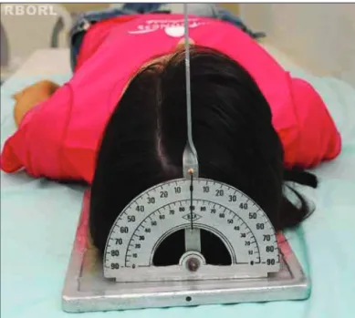 Table 2. Technical factors associated with the 45º side oblique  view.