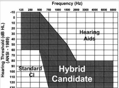 Figure 3. Amplified schematic showing the wave shape of electrodes  (sinus) in the silicone sheath with a wire structure.