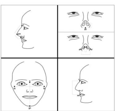 Figure 1. Anatomical parameters used for facial analysis. n: Nasion; 