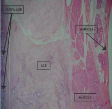 Figure 1  Photomicroscopy  of  rabbit  right  vocal  fold  3  weeks  after SCB implantation