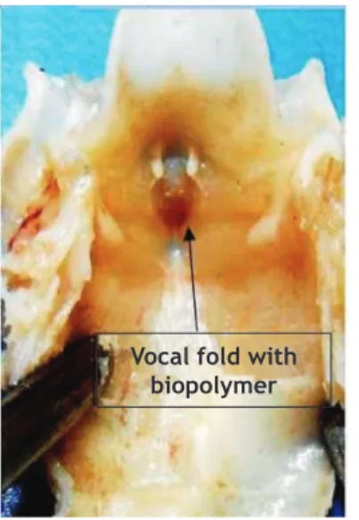 Figure 3  Photograph of rabbit larynx after 3 weeks of SCB  implantation in the right vocal fold