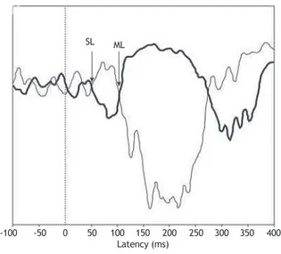 Figure 2 Signals recorded in the right soleus muscle. The thin  trace indicates the response from the anode positioned on the  right mastoid, and the thick line the response from the anode  positioned on the left mastoid