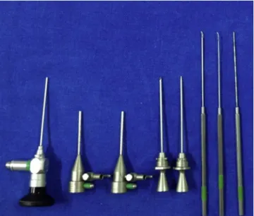 Figure 2 ALL being performed with the optical device in posi- posi-tion, reflux needle and triangulation for instrumentation.