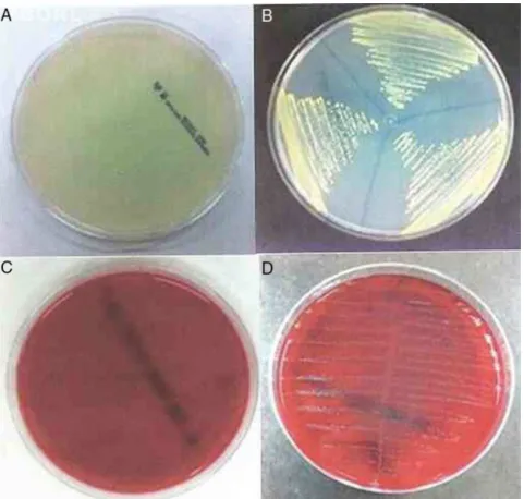Figure 2 Muller-Hinton agar plates: (A) no bacterial growth; (B) with bacterial growth