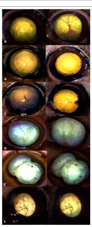 Figure  1  -  Image  of  posterior  capsules.  Left:  From  2  (C)  to  7  (A,F)  and  14  (B,D,E)  post-operative  days