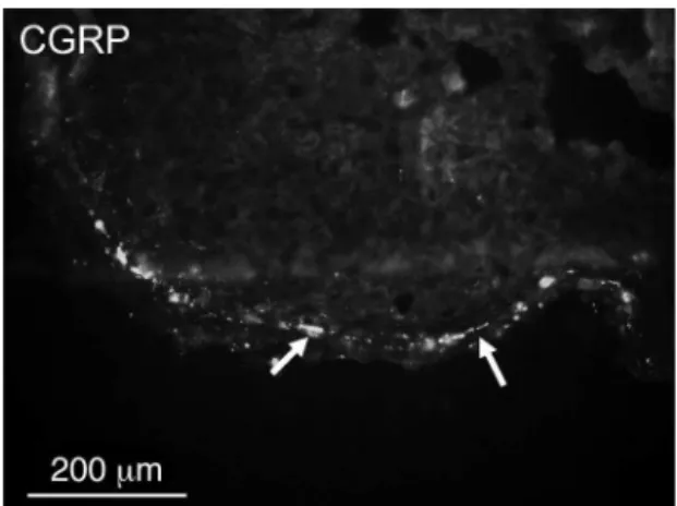 Table 2 Comparison of relative densities of PGP 9.5- and CGRP-immunoreactive nerve fibers.