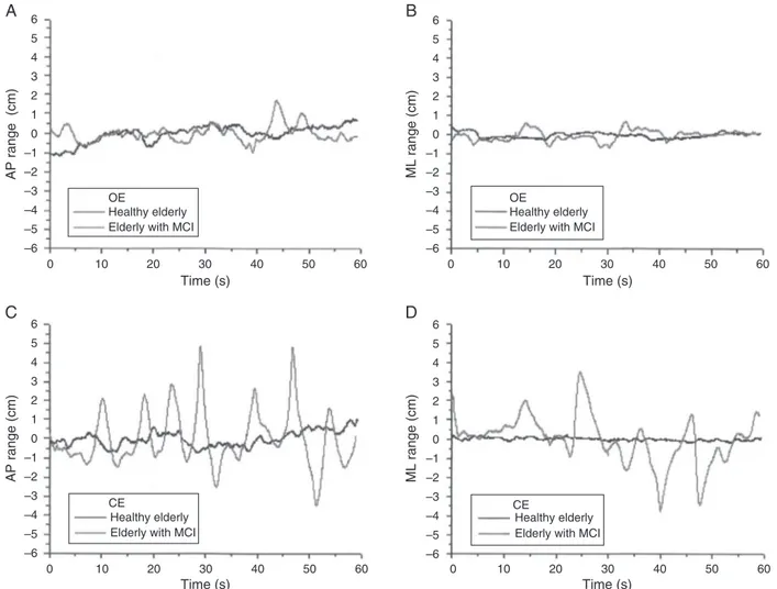 Figure 3 Stabilogram from a healthy elderly and from one with mild cognitive impairment (MCI)