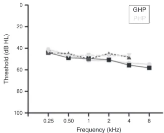 Figure 1 Audiograms of good and poor hearing aid perform- perform-ers.