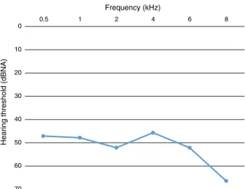 Figure 1 Profile of hearing loss according to average hearing threshold in frequencies.