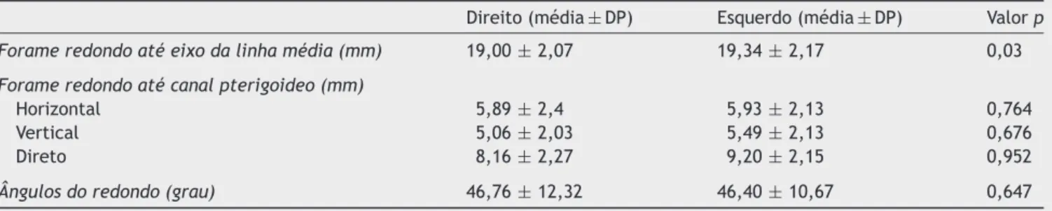 Tabela 1 Índice de medidas das distâncias do forame redondo em direc ¸ão ao eixo da linha média, canal pterigoideo e base da placa pterigoide lateral