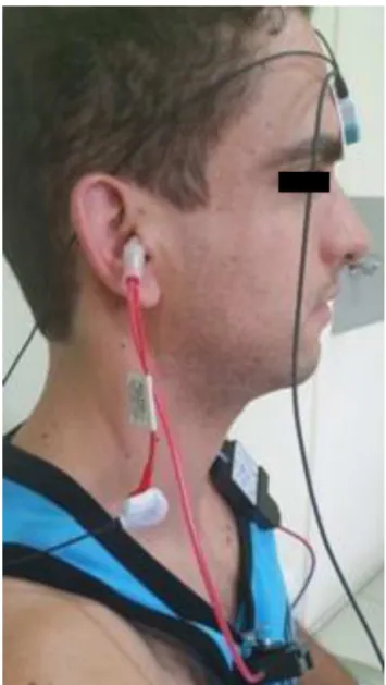 Figure 3 VEMP and ECochG specificity in the right and left ears. Sensitivity measures VEMP ECochG10090807060%504030 20 10 0 Right Left Ear