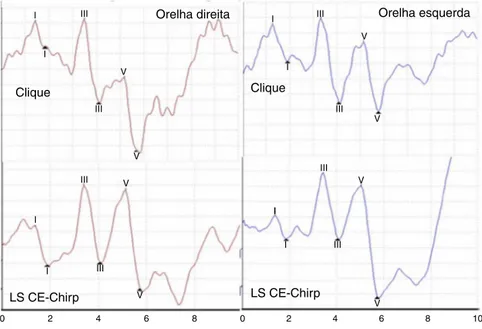 Figura 1 Exemplo do registro de PEATE com os estímulos clique e LS CE-chirp ® em um dos sujeitos do estudo