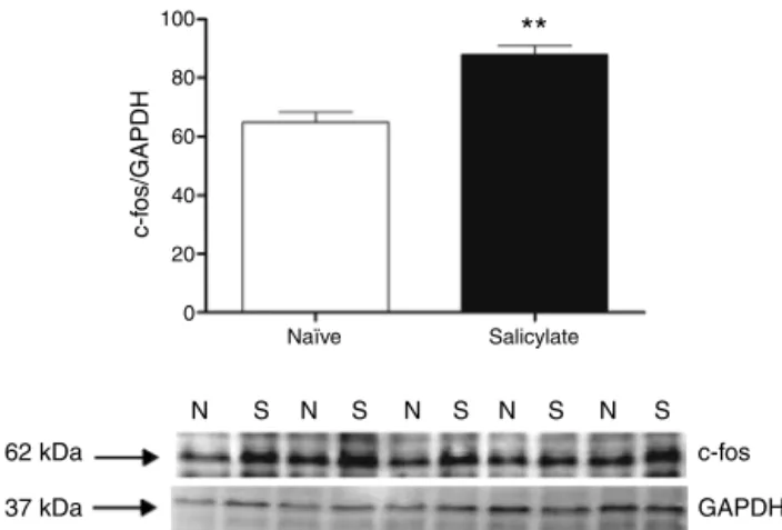 Figure 2 c-fos expression in the IC. Top quantification of c- c-fos expression. The c-fos signal intensity was normalized to the GAPDH signal intensity (**p = 0.0012; n = 5 for each group  con-taining material from 4 animals)