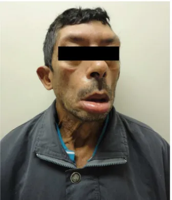 Figure 1 Patient’s front view.