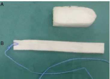 Figure 1 NasoPore (A) and gauze strip (B) packing.