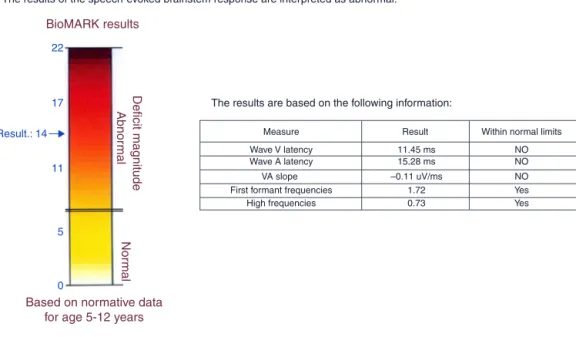 Figure 3 Auditory brainstem response (ABR) with speech stimulus and abnormal responses