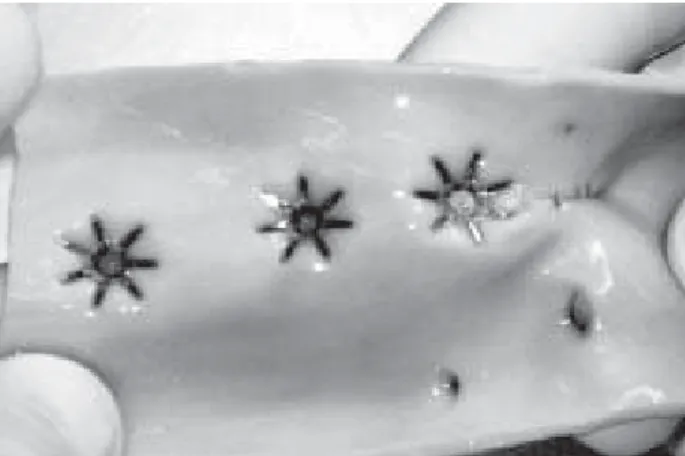Fig. 8 – Internal view of the pig’s aorta where several mechanical suture devices can be seen