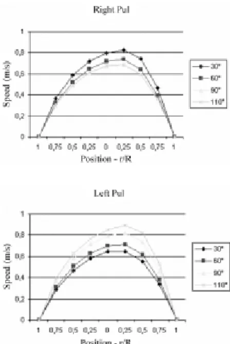 Fig. 7 - Pressure coefficient (Cp) in the subclavian artery in respect to the angle of the anastomosis (A) and of the diameter of the PTFE graft