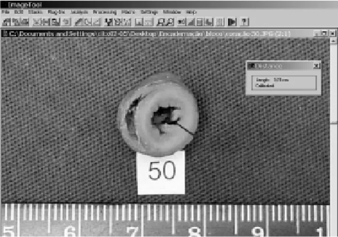 Fig. 2 – Representation of the measurement of the thickness of the left ventricular wall utilizing the Image Tool software