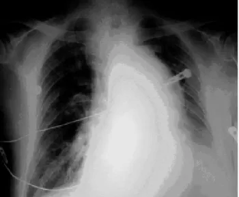 Fig. 2 – 3-D angioresonance during the first hospitalization