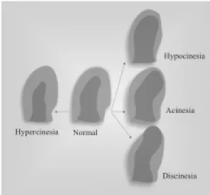 Fig. 1 – Myocardial response to stress