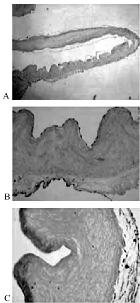 Fig. 3 - Análise histológica de homoenxerto criopreservado explantado com 5 meses de evolução