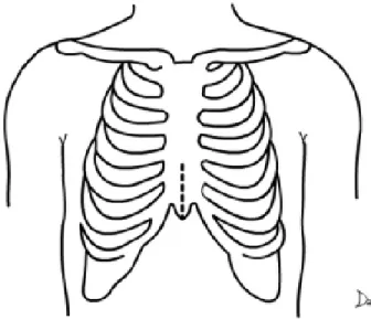 Fig. 1 - Limited sternal incision utilizing this technique
