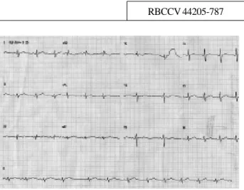 Fig. 1 - Eletrocardiograma pré-operatório