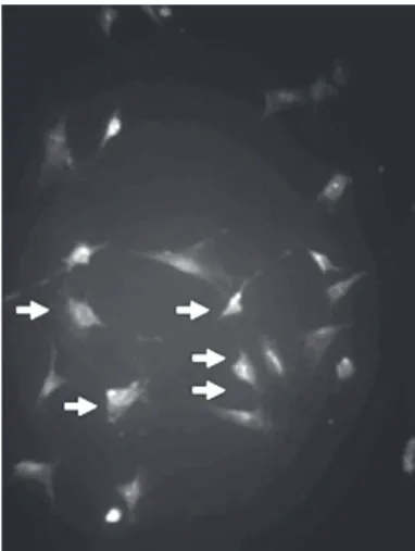 Fig. 1 – Mesenchymal cell culture (arrows) identified by the anti- anti-vimentin antibody (Immunofluorescence, x 200)