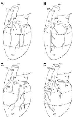 Fig. 1 - Diagram showing the coexistence of the anterosuperior, diagonal and lateral branches from the left side view of the heart (4 cases; in A, B and D  right coronary artery dominance; in C  -balanced coronary circulation)